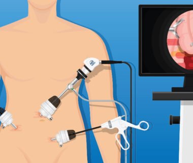 Laparoscopic surgery hospital Dubai