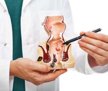 Best Hemorrhoids treatment UAE