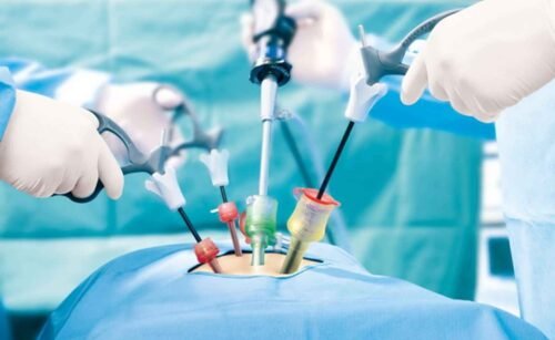 Top laparoscopic surgeons in Dubai