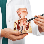 Which Doctor to See for Colorectal Problems?