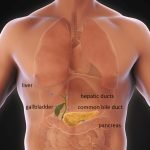 Gallbladder Surgery Cost in Dubai