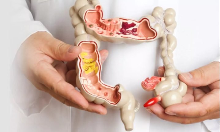 Best colorectal surgeon in dubai