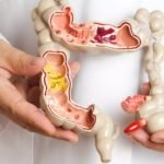 How Serious is Colorectal Surgery?
