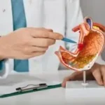 What is the Difference Between Gastrologist and Gastroenterologist