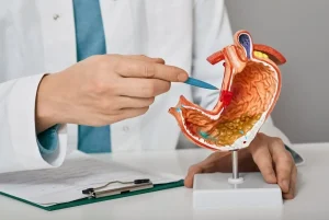How Is Life After Colon Removal